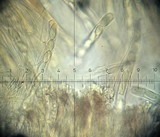 Plectania melastoma image