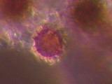 Scleroderma macrorhizon image