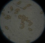 Inocybe rimosa image
