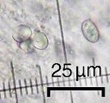 Lecanora cenisia image