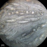 Pertusaria ostiolata image