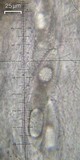 Pertusaria ostiolata image