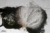 Pertusaria ostiolata image