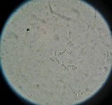 Exidia recisa image