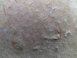 Phellinus robiniae image