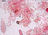 Pluteus petasatus image