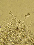 Hemimycena tortuosa image