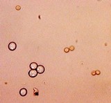 Aspergillus alliaceus image