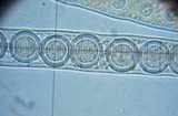 Pseudoplectania melaena image