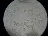 Lepista personata image