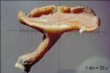 Hymenoscyphus fraxineus image
