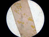Phycomyces blakesleeanus image