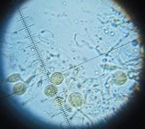 Craterocolla cerasi image