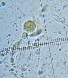 Craterocolla cerasi image