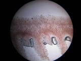 Psathyrella piluliformis image
