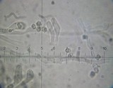 Hydnellum chrysinum image