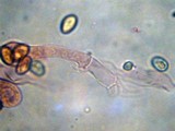 Meottomyces dissimulans image