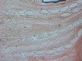 Plectania rhytidia image