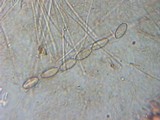 Plectania rhytidia image