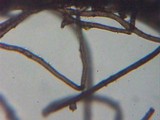 Plectania rhytidia image