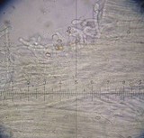Meottomyces dissimulans image