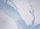 Meottomyces dissimulans image