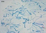 Meottomyces dissimulans image