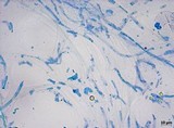Meottomyces dissimulans image