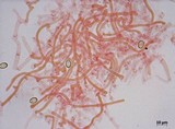 Meottomyces dissimulans image