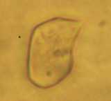 Nolanea holoconiota image
