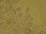 Acanthobasidium penicillatum image