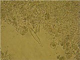 Acanthobasidium penicillatum image