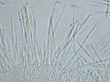 Dasyscyphella montana image