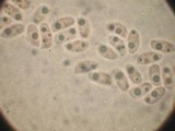 Hyphodontia quercina image