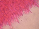 Hyphodontia quercina image