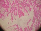 Hyphodontia quercina image