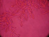 Cinereomyces lindbladii image