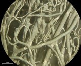 Usnea cavernosa image