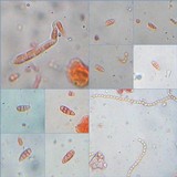 Collema tenax var. tenax image