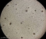 Dermatocarpon americanum image