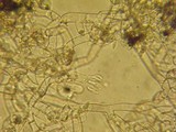 Botryobasidium obtusisporum image