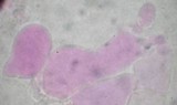 Botryobasidium subcoronatum image