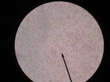 Inocybe lacera image