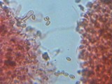 Bolbitius psittacinus image