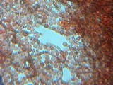 Arcyria denudata image