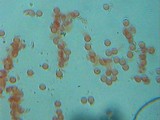 Arcyria denudata image