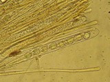 Wynnella silvicola image