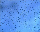 Calocybe gambosa image