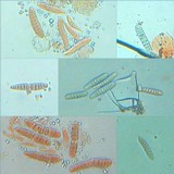 Graphis elegans image