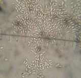 Xylaria cubensis image